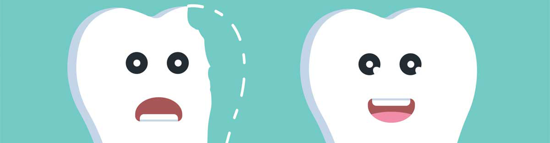 rendering of a chipped tooth by a whole tooth