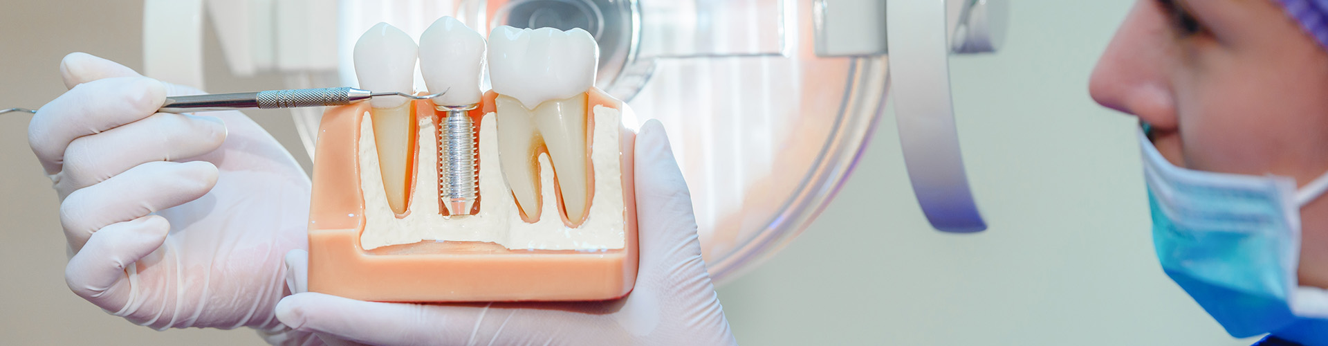 dentist holding model of dental implant between teeth