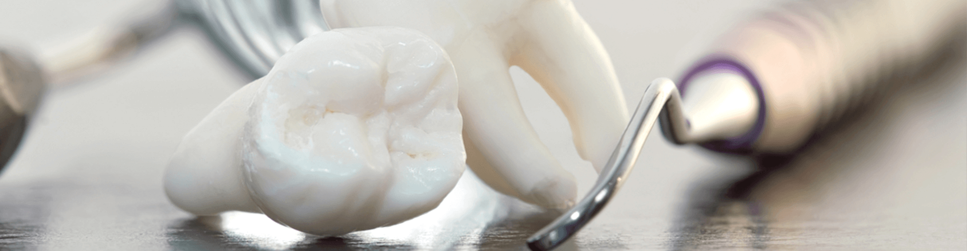 Extracted teeth with dental tools.