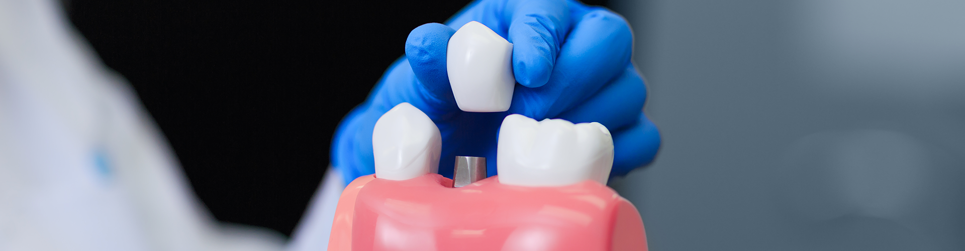 gloved hands holding a model of a dental crown