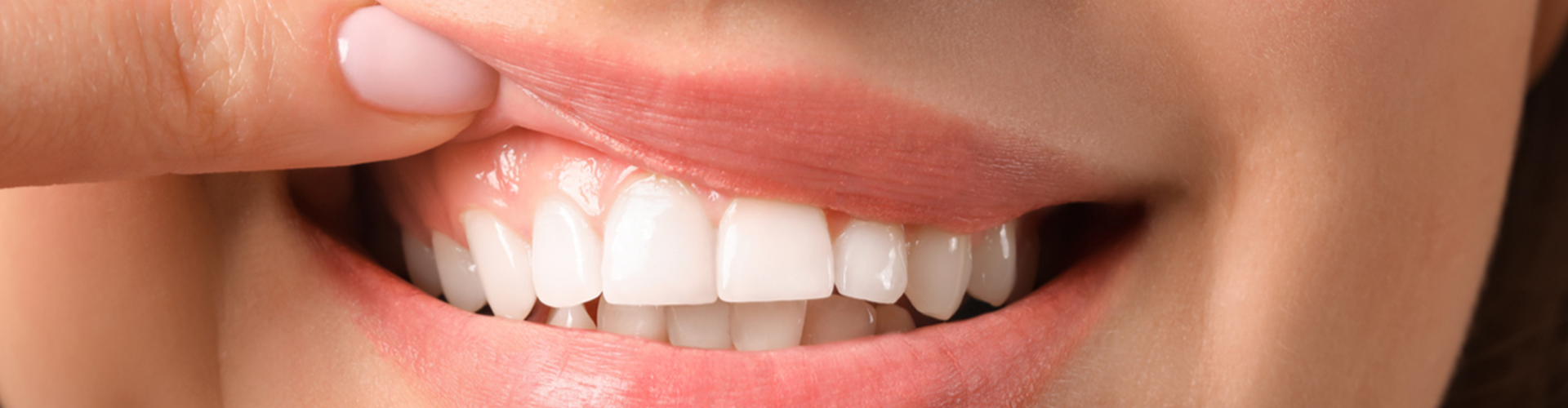 woman lifting lip to show gums