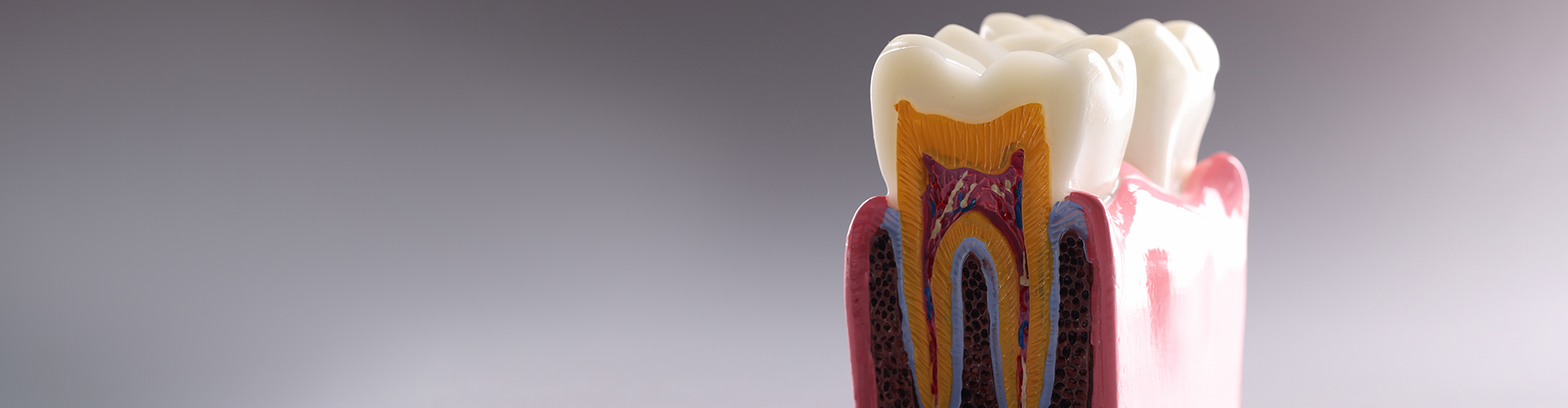 Model of a bisected tooth.