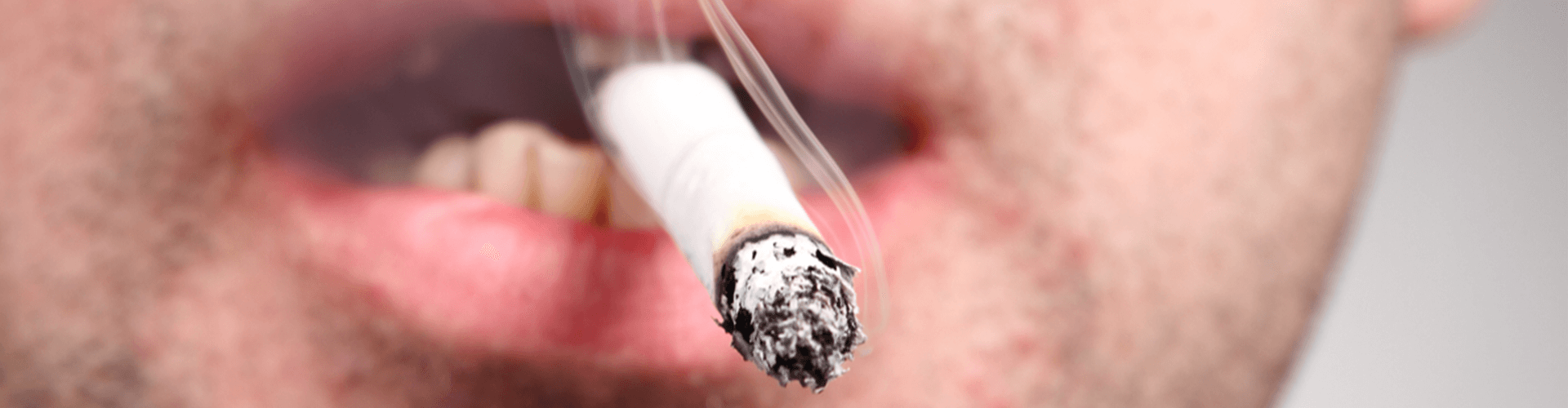 Male with cigarette in mouth.