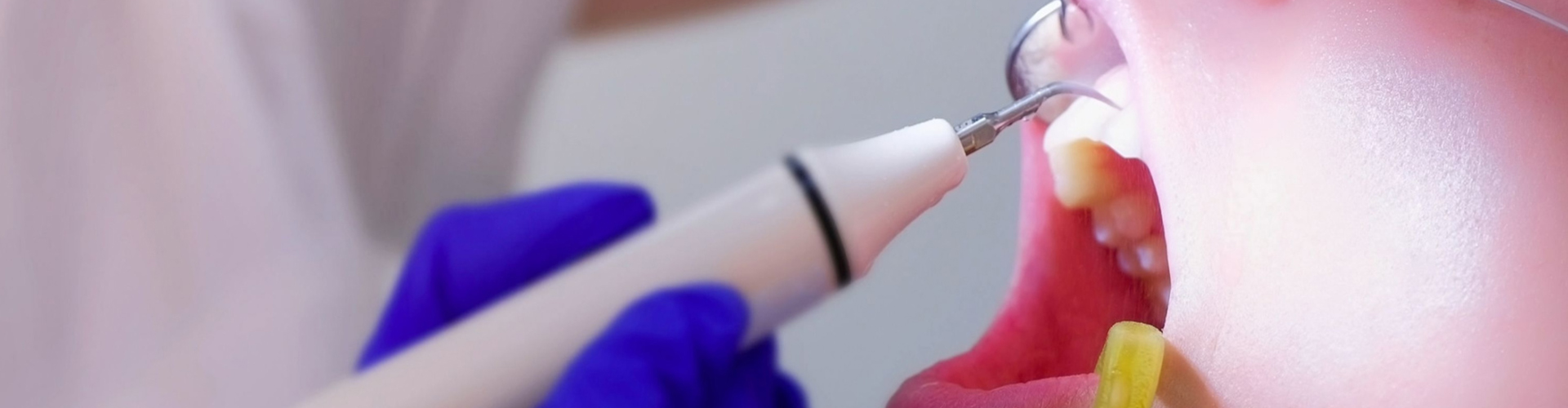 patient having a teeth cleaning