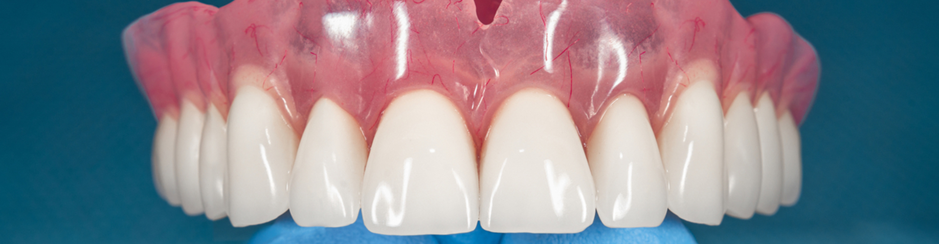 upper denture in hand