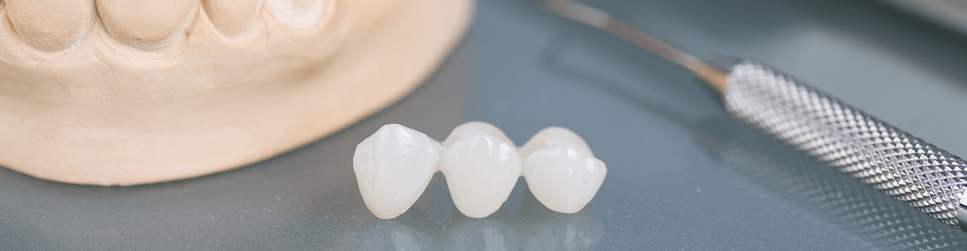 dental bridge sitting in front of gum model