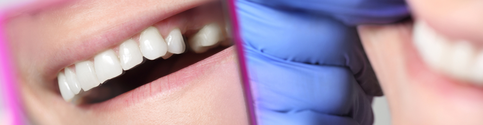 tooth gap reflection in a mirror