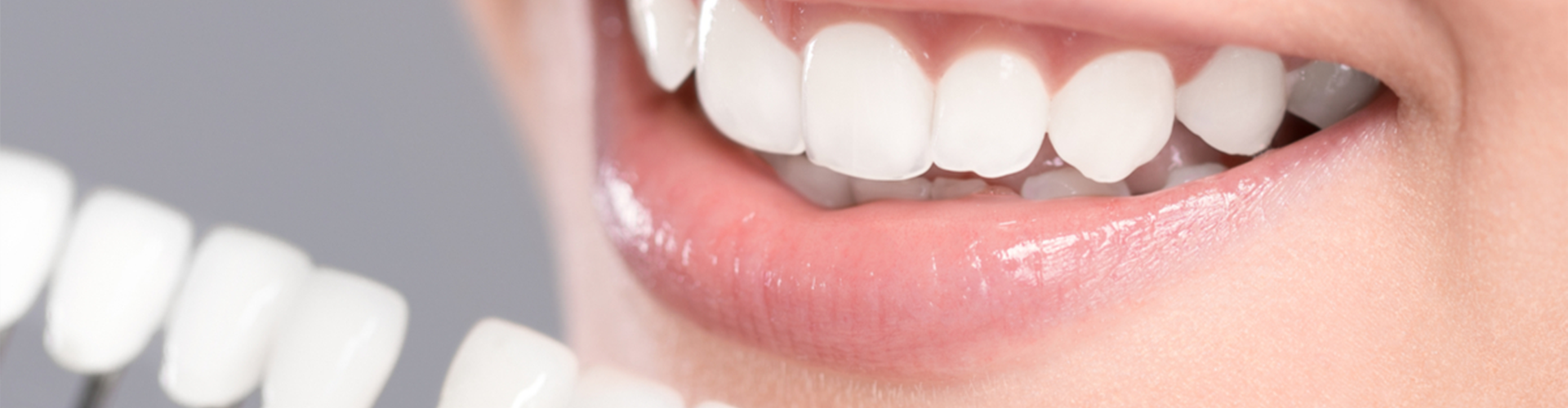 comparing whitening shades on teeth