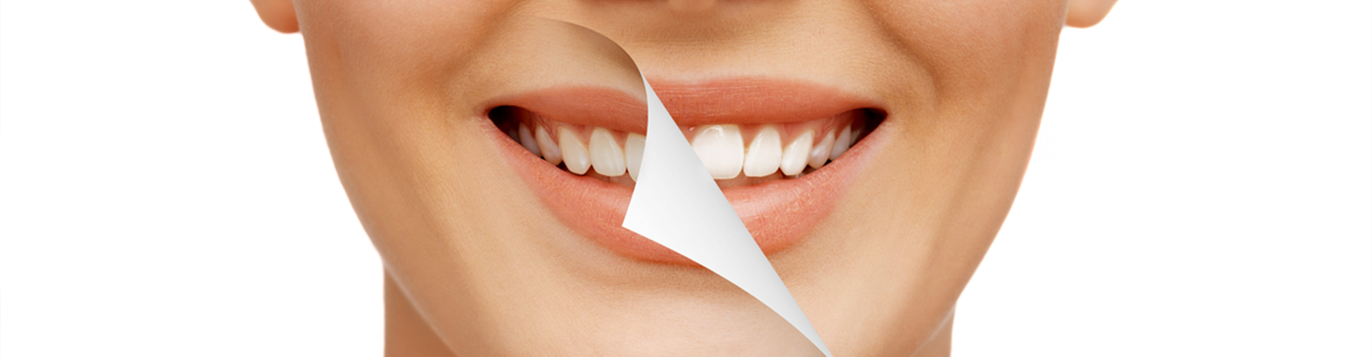 new smile being revealed behind old smile