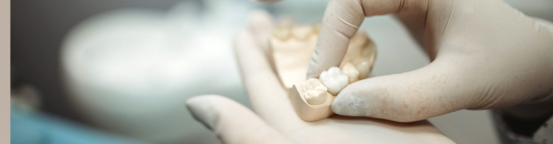 gloved hands holding jaw model with crown on tooth