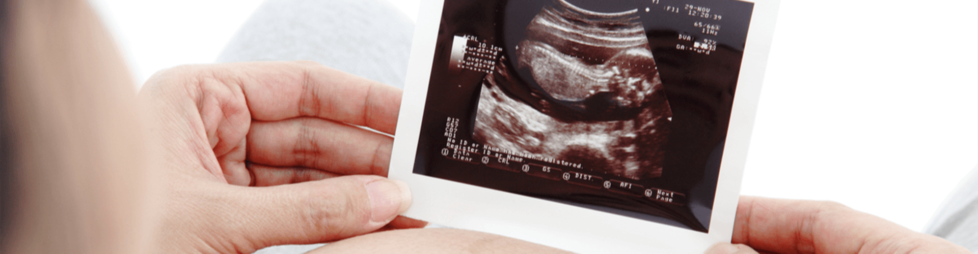 Pregnant female holding a sonogram photo on her stomach.