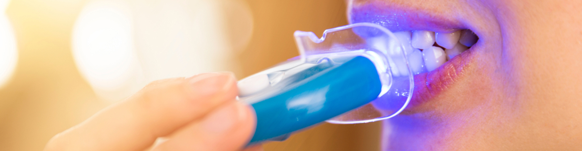 female having teeth whitened with light