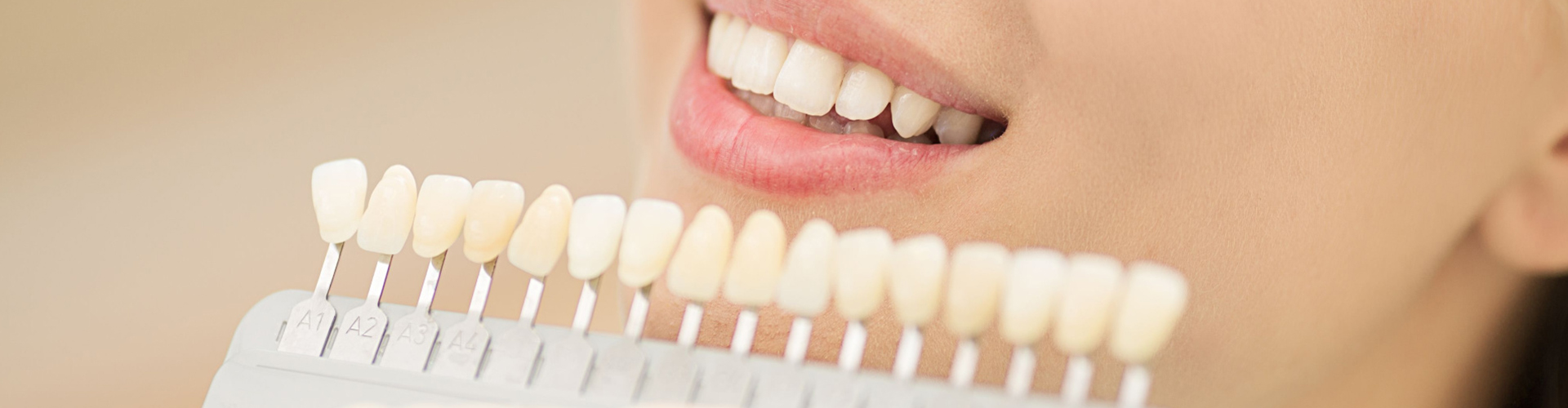 Woman having teeth color matched.