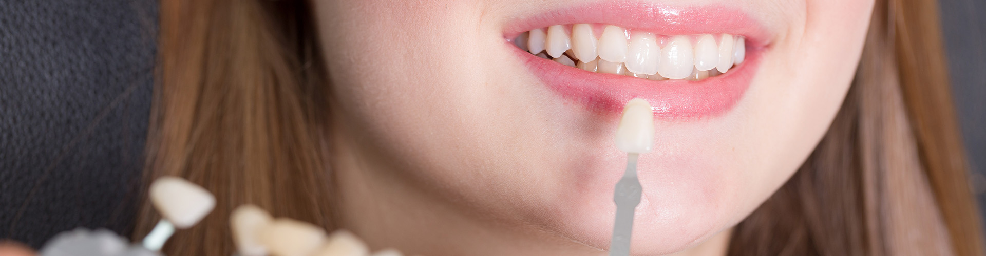 A woman smiling while holding a sample veneer in front of her teeth to check the ideal color.