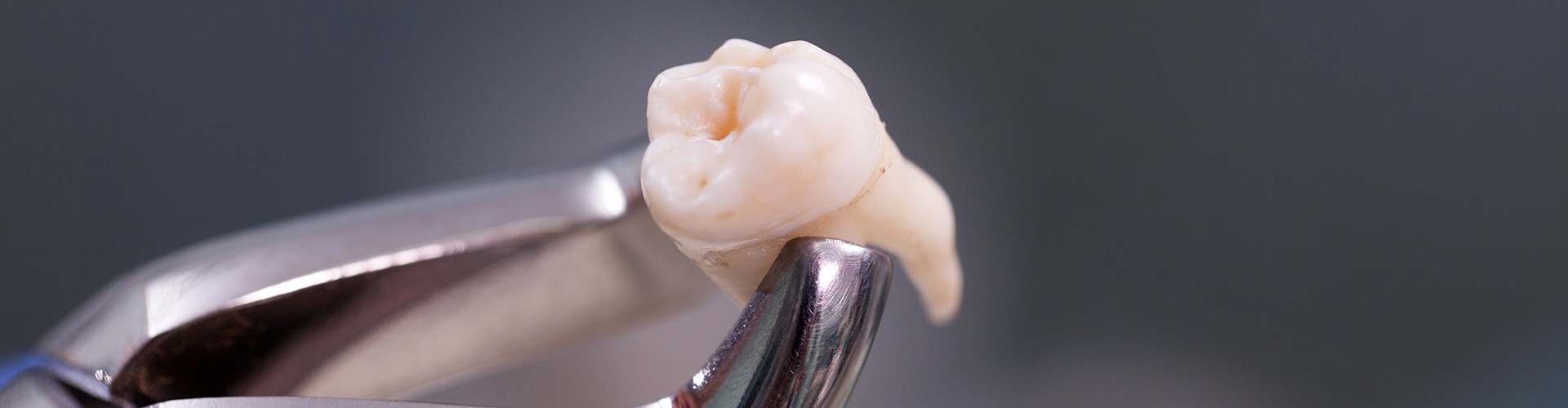 Extracted tooth held by forceps.