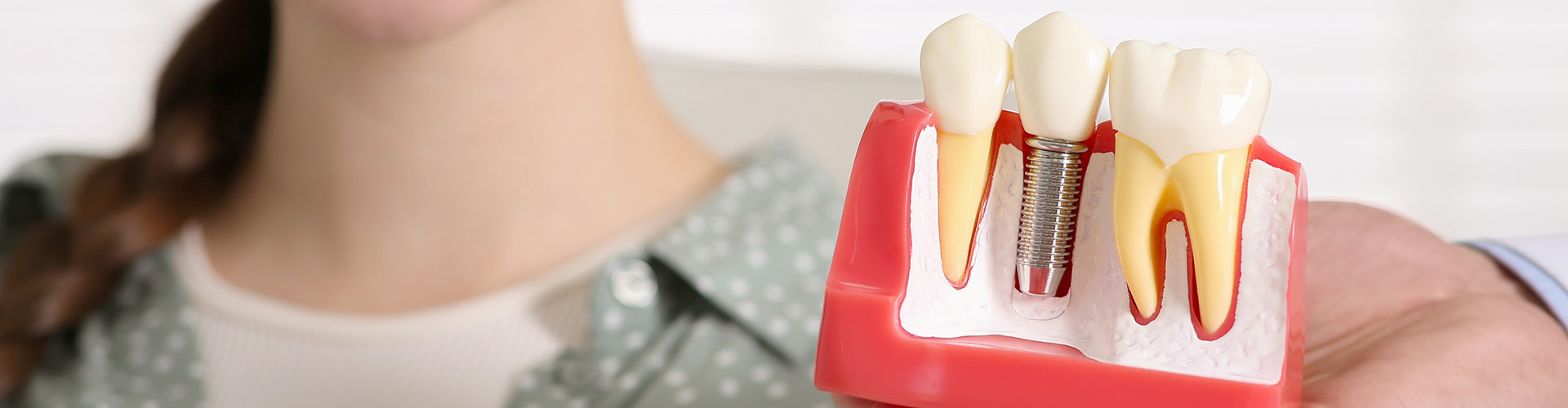 A dental model demonstrating how a dental implant is placed.
