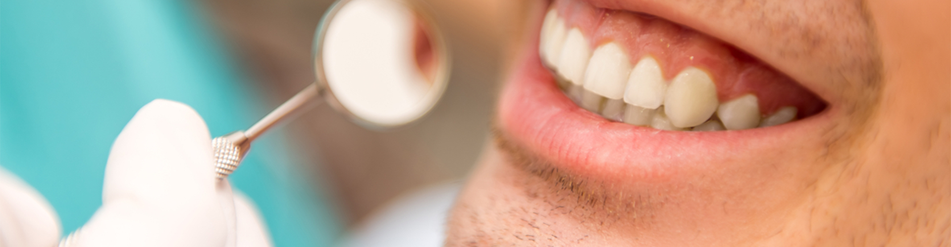 smiling mouth next to a dental mirror
