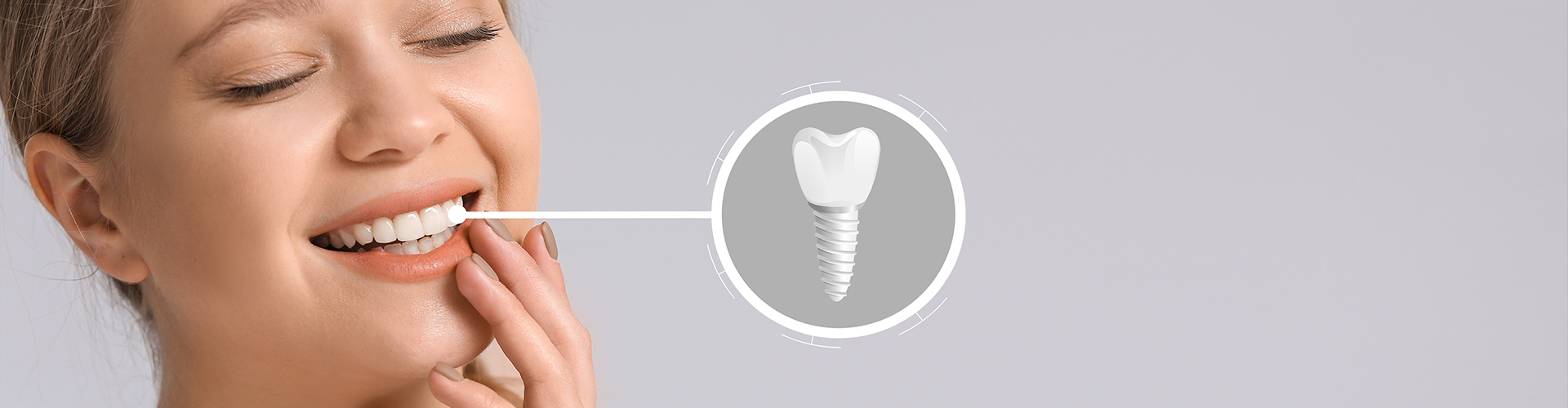 Rendering of a dental implant beside a smiling woman.