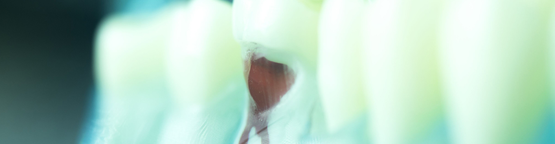 Rendering of a tooth's root canals.