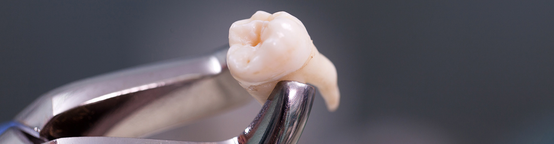 dental pliers holding an extracted tooth