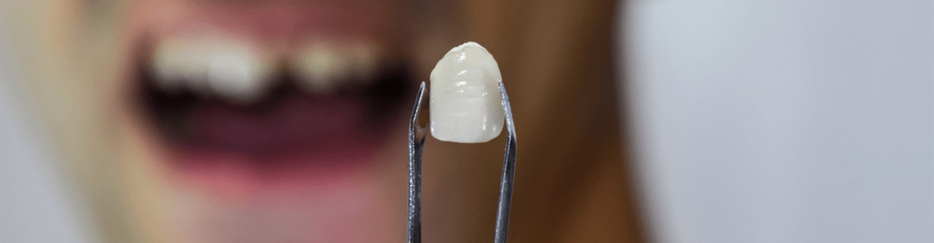Man holding a tooth with tweezers.