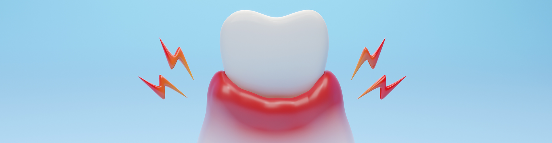 rendering of a tooth in inflamed gums