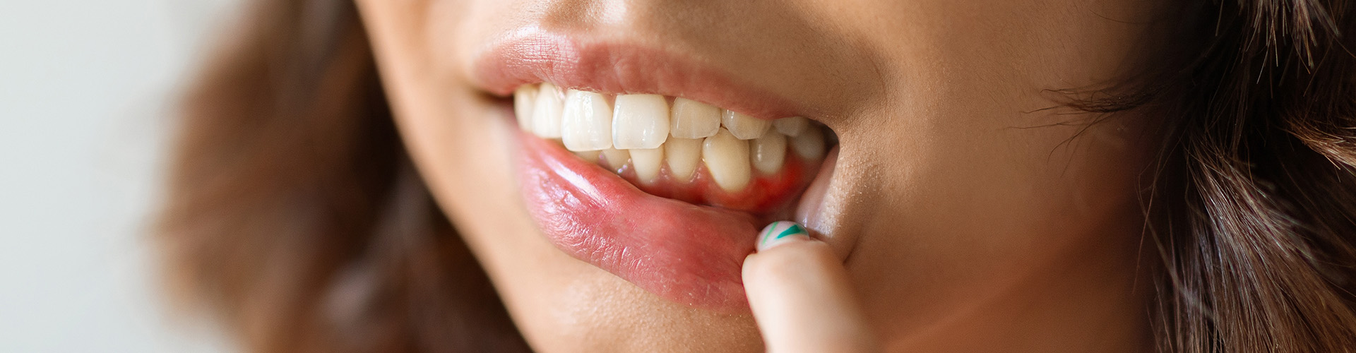 woman pulling down lip to reveal inflamed gum